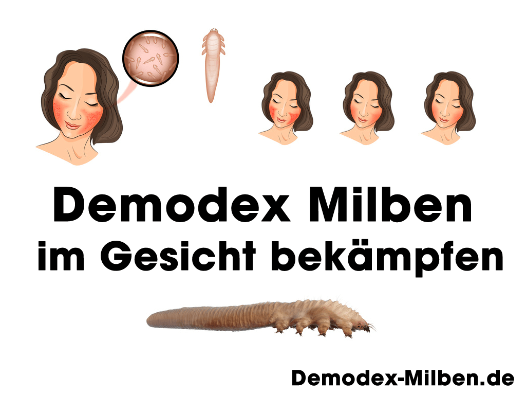 (c) Demodex-milben.de